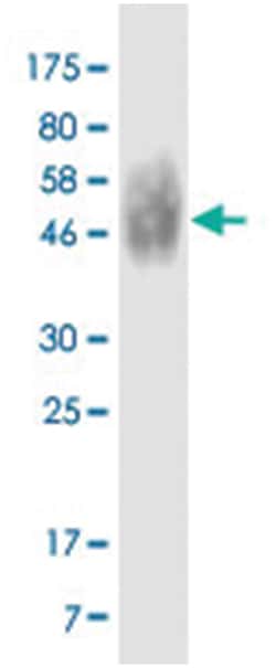 anti-CD86, Clone: 3A6, Abnova 100 &mu;g | Buy Online | Abnova Corporation | Fisher Scientific