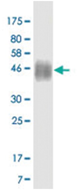 anti-CD86, Clone: 3F2, Abnova 100 &mu;g | Buy Online | Abnova Corporation | Fisher Scientific