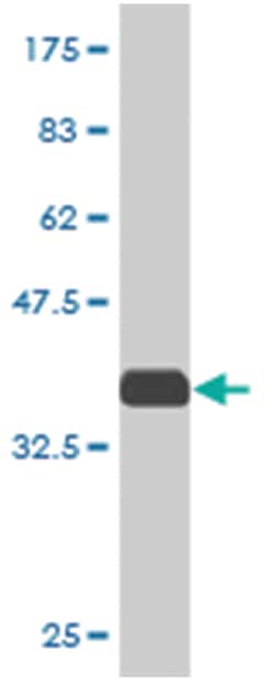 TNFRSF8, Mouse, Clone: 4C9, Abnova 100&mu;g; Unlabeled:Antibodies, Monoclonal