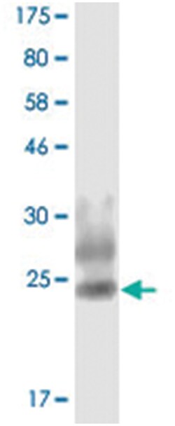 anti-TNFSF8, Clone: 4A10, Abnova 100 &mu;g | Buy Online | Abnova Corporation | Fisher Scientific