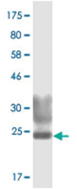 anti-TNFSF8, Clone: 4A6, Abnova 100&mu;g, Unlabeled:Antibodies, Monoclonal