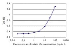 CD40LG, Human, Matched Antibody Pair (AP11), Abnova&trade;