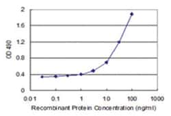 CD40LG, Human, Matched Antibody Pair (AP12), Abnova&trade;