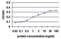 CD40LG, Human, Matched Antibody Pair (AP13), Abnova&trade;