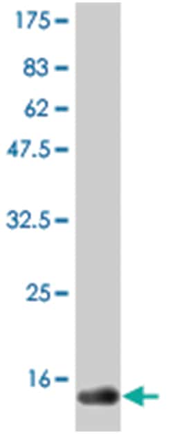 CD40 ligand, Mouse, Clone: 3E4, Abnova 100 &mu;g | Buy Online | Abnova Corporation | Fisher Scientific