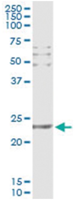 anti-CD69, Human, IP-WB Antibody Pair, Abnova 1 Set:Antibodies, Monoclonal/Polyclonal