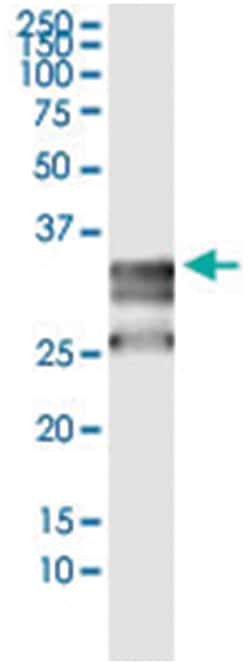CD79B, Human, IP-WB Antibody Pair (PW3), Abnova™