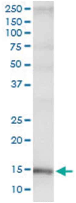 anti-CDA, Human, IP-WB Antibody Pair, Abnova&trade;