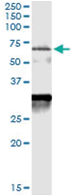 anti-CDC25A, Human, IP-WB Antibody Pair, Abnova 1 Set | Buy Online | Abnova | Fisher Scientific