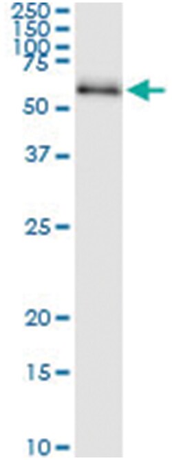 CDC25C, Human, IP-WB Antibody Pair (PW1), Abnova™