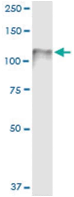 anti-CDH3, Human, IP-WB Antibody Pair, Abnova 1 Set:Antibodies, Monoclonal/Polyclonal