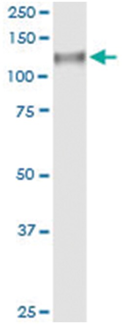 anti-CDH13, Human, IP-WB Antibody Pair, Abnova&trade;