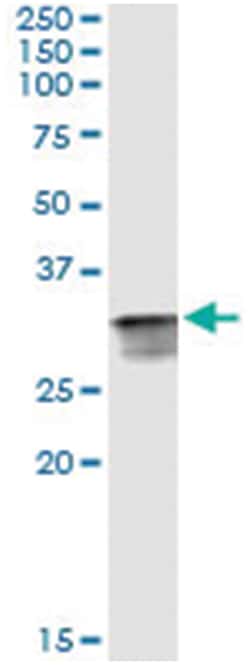 anti-CDK2, Human, IP-WB Antibody Pair, Abnova&trade;