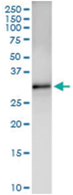 anti-CDK5, Human, IP-WB Antibody Pair, Abnova&trade;