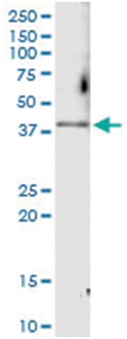 anti-CDK6, Human, IP-WB Antibody Pair, Abnova&trade;