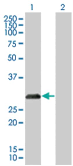 CDKN1B 293T Cell Overexpression Lysate 2 (Denatured), Abnova 100 &mu;l:Reagenzien