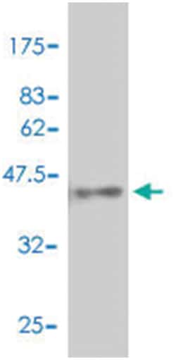 CDKN2B, Mouse, Polyclonal Antibody, Abnova 50&mu;L; Unlabeled:Antibodies,