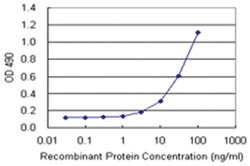 anti-CDKN2D Matched Antibody Pair, Abnova
