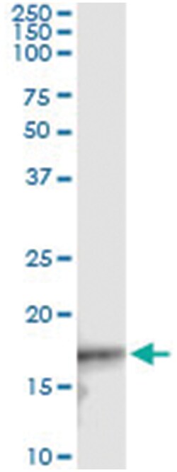 anti-CDKN2D, Human, IP-WB Antibody Pair, Abnova™