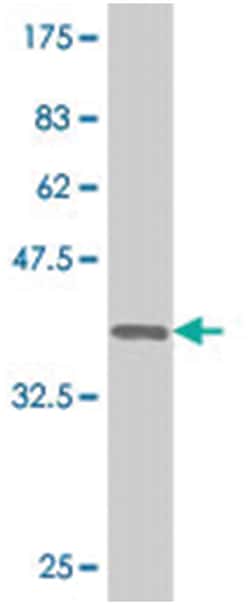 CDX1, Mouse, Clone: 1E9, Abnova 100&mu;g; Unlabeled:Antibodies, Monoclonal