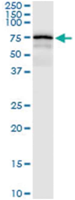anti-CENPB, Human, IP-WB Antibody Pair, Abnova 1 Set:Antibodies, Monoclonal/Polyclonal