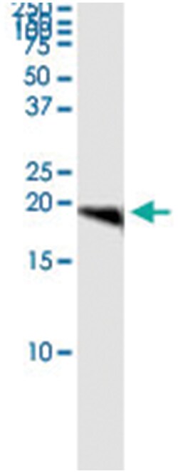 anti-CETN1, Human, IP-WB Antibody Pair, Abnova&trade;
