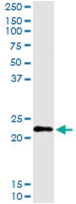 anti-CGB, Human, IP-WB Antibody Pair, Abnova&trade;