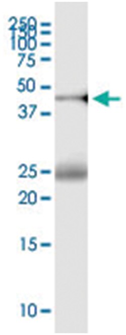 RCC1, Human, IP-WB Antibody Pair (PW3), Abnova 1 Set:Antibodies, Monoclonal/Polyclonal