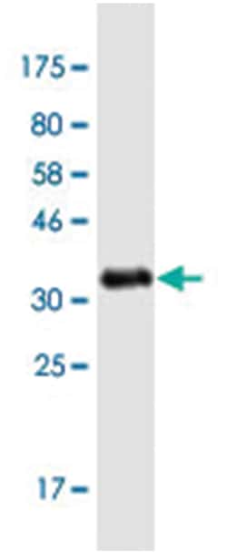 CHD1 (M04A), Mouse anti-Human, Clone: 1G2, Abnova 200 &mu;L | Buy Online | Abnova | Fisher Scientific