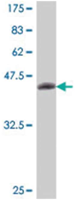 CHRNA2, Mouse, Polyclonal Antibody, Abnova 50&mu;L; Unlabeled:Antibodies,