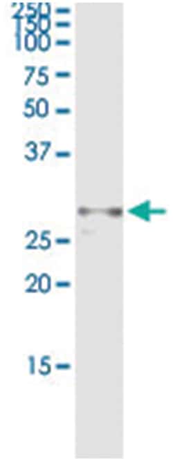 CIDEA, Human, IP-WB Antibody Pair (PW3), Abnova&trade;