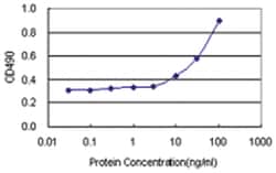 anti-CIRBP Matched Antibody Pair, Abnova&trade;