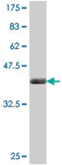 CKM, Mouse, Polyclonal Antibody, Abnova 50&mu;L; Unlabeled:Antibodies,