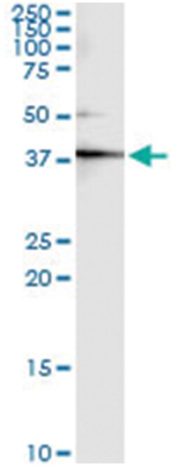CKM, Human, IP-WB Antibody Pair (PW1), Abnova 1 Set:Antibodies, Monoclonal/Polyclonal