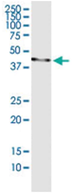 anti-ERCC8, Human, IP-WB Antibody Pair, Abnova 1 Set:Antibodies, Monoclonal/Polyclonal