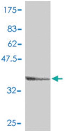 AP1S1, Mouse, Polyclonal Antibody, Abnova 50&mu;L; Unlabeled:Antibodies,
