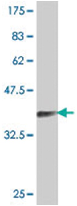 AP2S1, Mouse, Polyclonal Antibody, Abnova 50 &mu;L | Buy Online | Abnova Corporation | Fisher Scientific