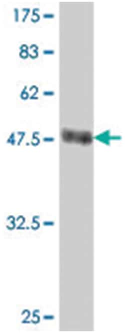 CLIC1, Mouse, Polyclonal Antibody, Abnova 50 &mu;L | Buy Online | Abnova Corporation | Fisher Scientific