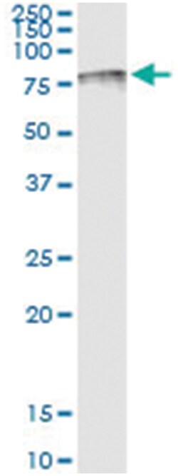 anti-TPP1, Human, IP-WB Antibody Pair, Abnova™