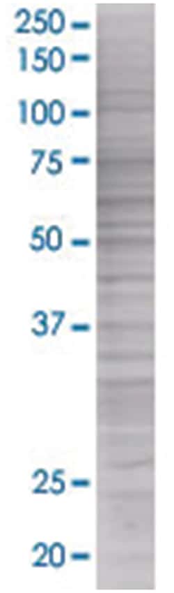 TPP1 293T Cell Overexpression Lysate (Denatured), Abnova 100 &mu;l | Buy Online | Abnova | Fisher Scientific