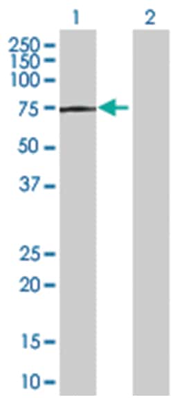 TPP1 293T Cell Overexpression Lysate (Denatured), Abnova 100 &mu;l | Buy Online | Abnova | Fisher Scientific