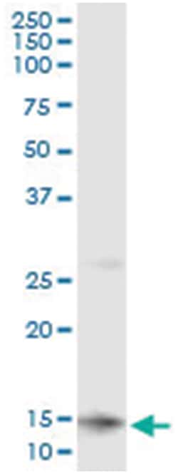 CLPS, Human, IP-WB Antibody Pair (PW2), Abnova™