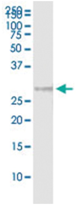 anti-CLTB, Human, IP-WB Antibody Pair, Abnova 1 Set:Antibodies, Monoclonal/Polyclonal