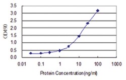 anti-CNTF, Human, Matched Antibody Pair, Abnova&trade;