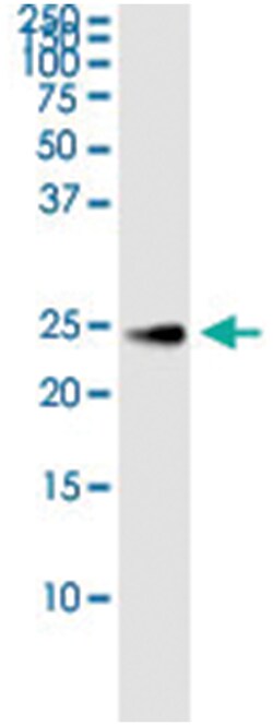anti-CNTF, Human, IP-WB Antibody Pair, Abnova 1 Set:Antibodies, Monoclonal/Polyclonal