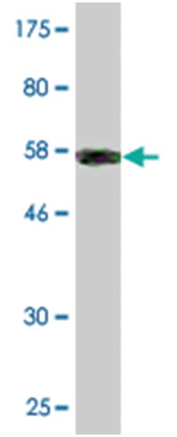 COL2A1, Mouse, Clone: 1E1, Abnova 100&mu;g; Unlabeled:Antibodies, Monoclonal