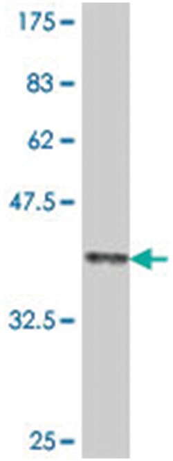 COL11A2, Mouse, Polyclonal Antibody, Abnova 50&mu;L; Unlabeled:Antibodies,