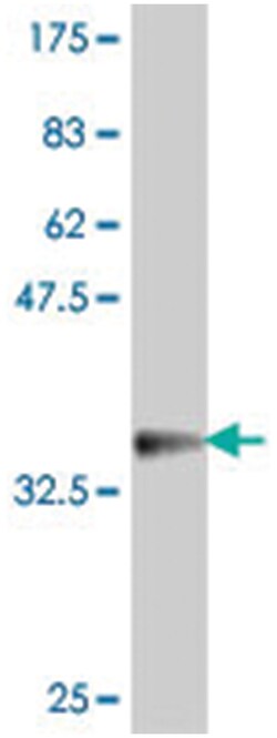 COL19A1, Mouse, Polyclonal Antibody, Abnova 50&mu;L; Unlabeled:Antibodies,