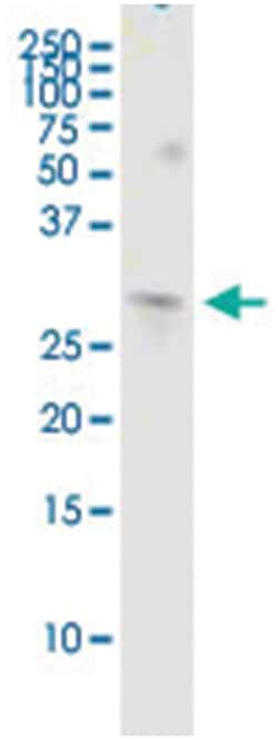 anti-COMT, Human, IP-WB Antibody Pair, Abnova 1 Set:Antibodies, Monoclonal/Polyclonal