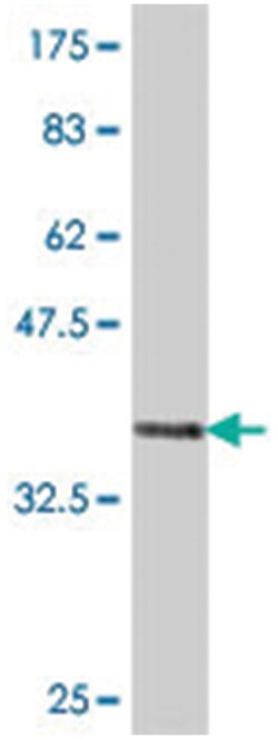 COPA, Mouse, Polyclonal Antibody, Abnova 50&mu;L; Unlabeled:Antibodies,